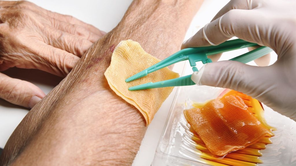 a man is applying a bandage on his arm to protect the wound from infection.