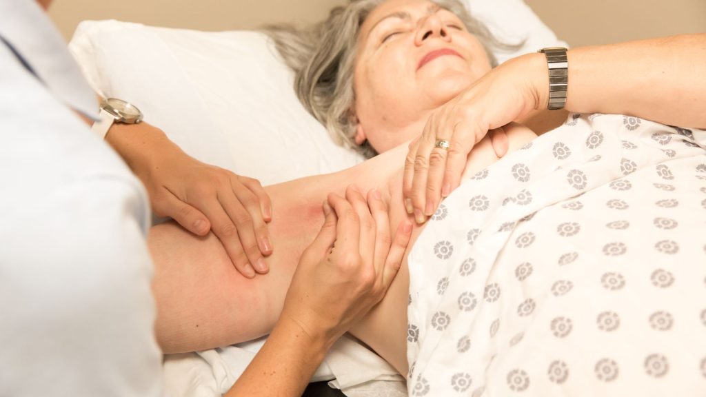 Hidradenitis Suppurativa Stages hidradenitis suppurativa stages, hs wound care