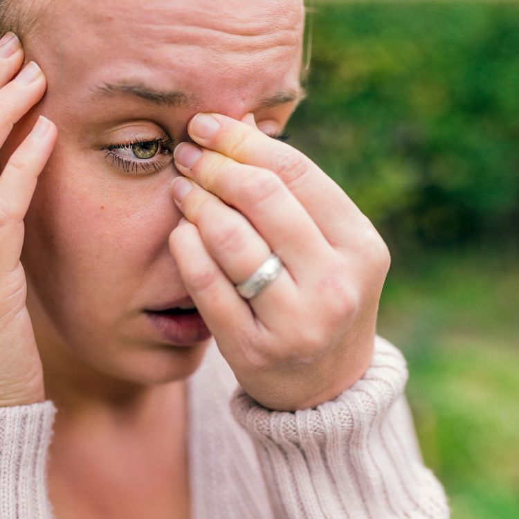 a woman with hs hidradenitis suppurativa holding her eyes with her fingers.