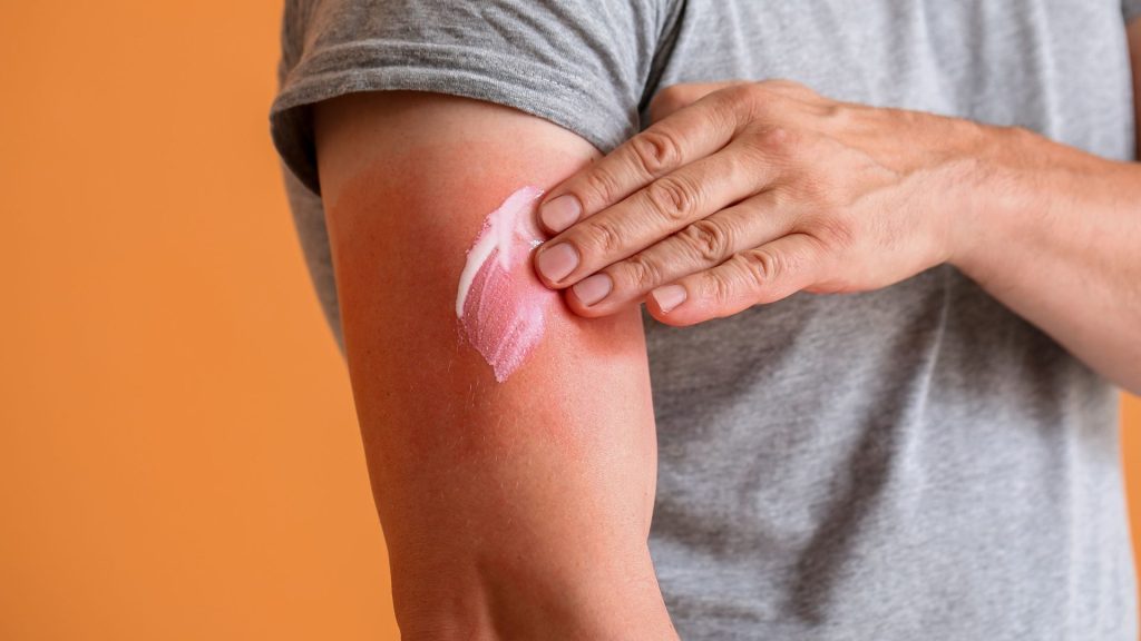 a man is applying lotion on his arm for his hs skin condition treatment