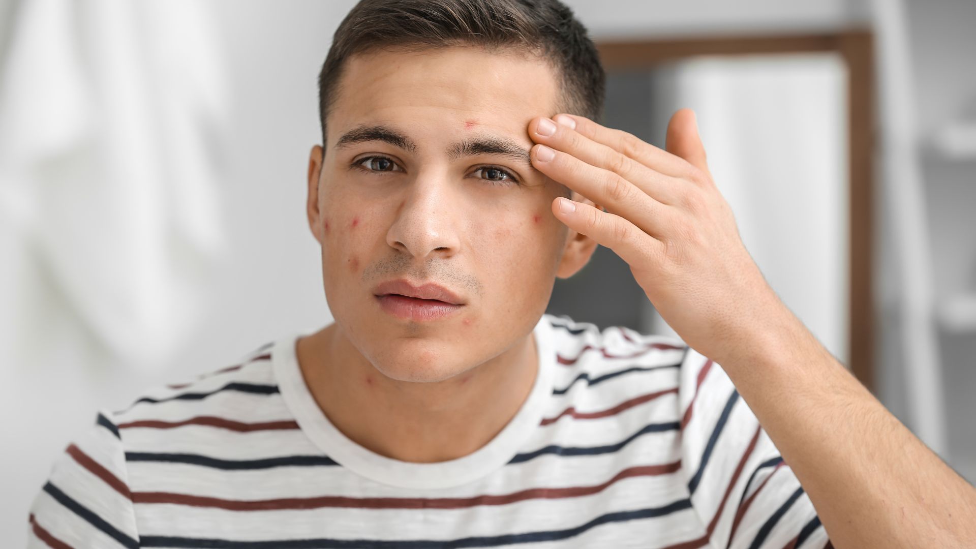 A man is experiencing discomfort on his face and seeks self-care for Hidradenitis Suppurativa Treatment at Home.