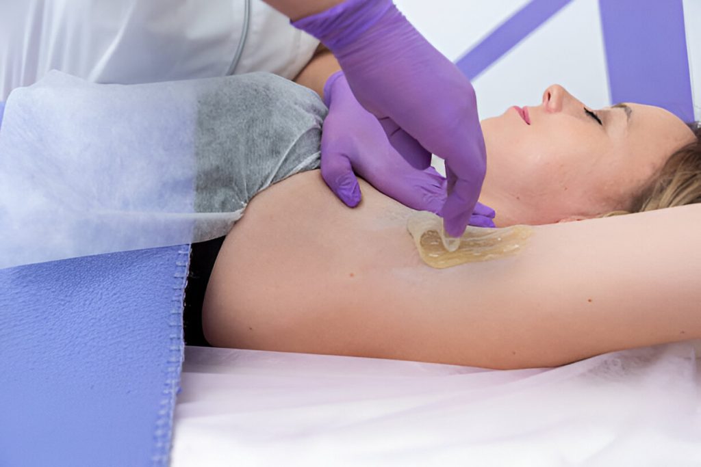 a person lies on a treatment bed while a professional wearing purple gloves applies a topical wax treatment to the person's armpit.